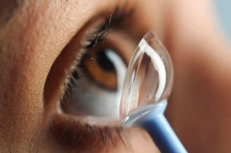 Adaptação de lente de contato para ceratocone na Eye Center